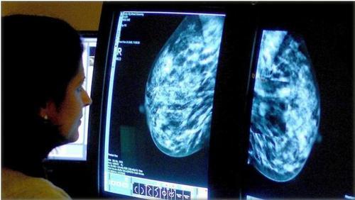 澳大利亚华人移民欠缺癌症支持 语言障碍影响治疗