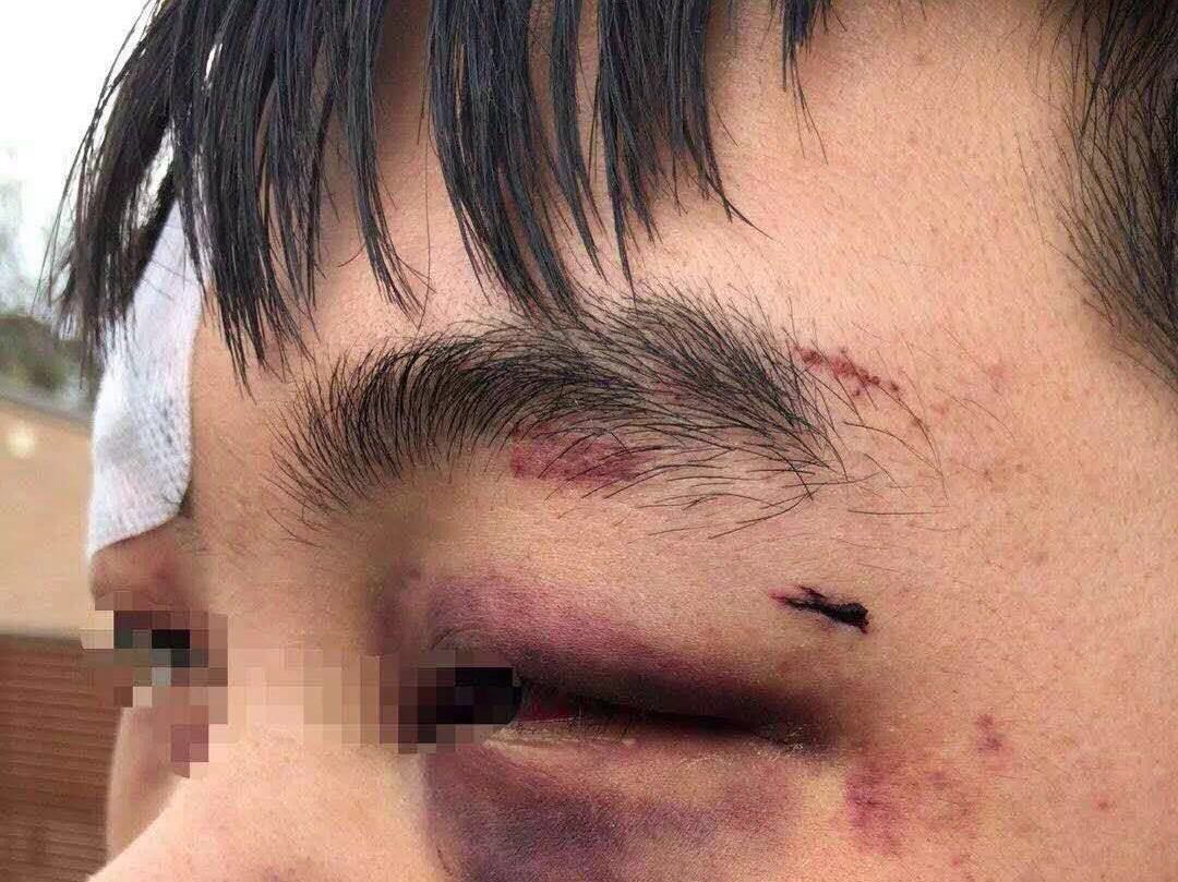 澳大利亚: 中国留学生遭暴力殴打 首都华人自发开车护送同胞